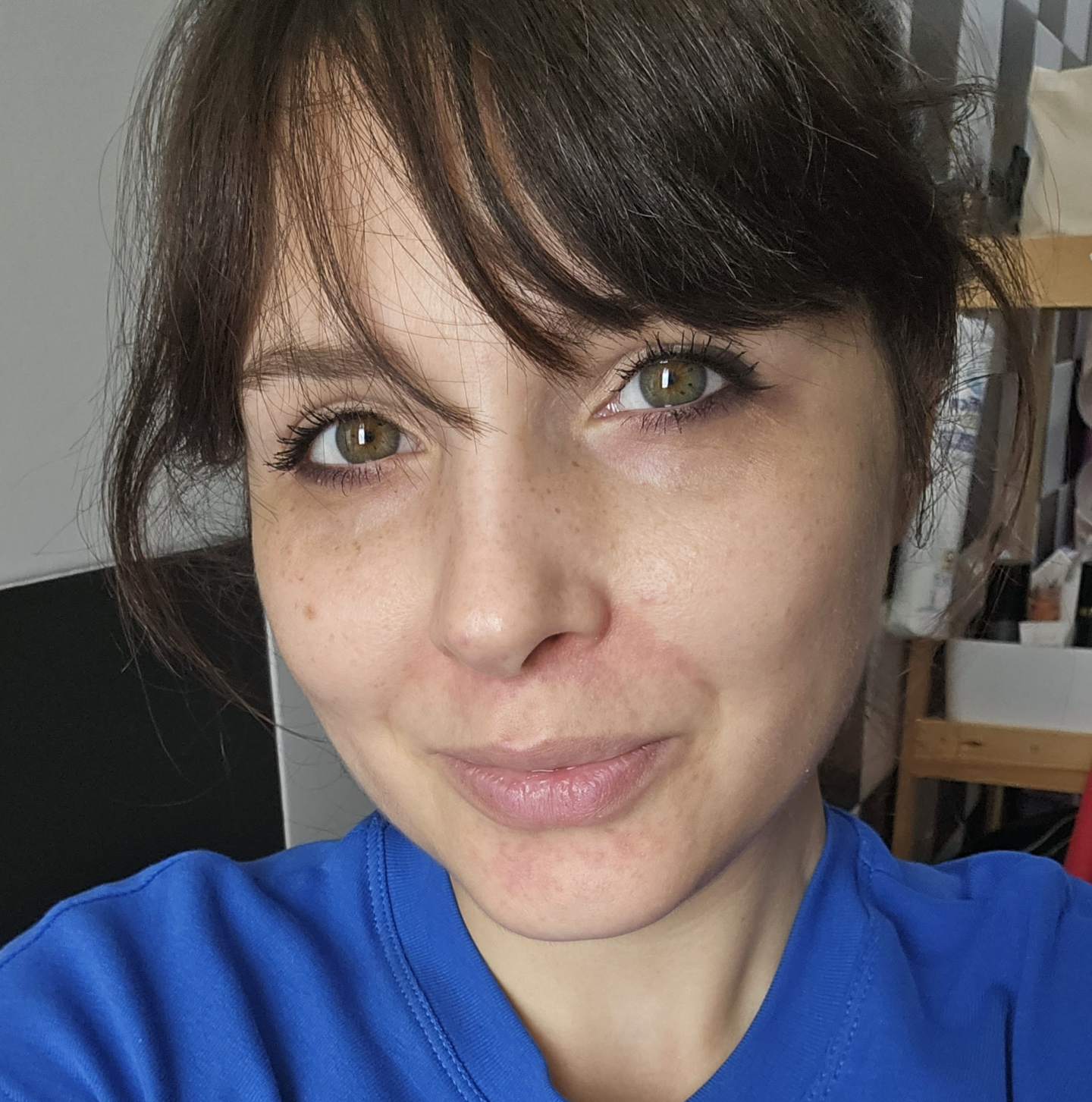 ragazza con manifestazione cutanea da malattia rara